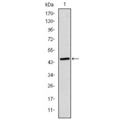 Western blot analysis using ApoB antibody against human ApoB (AA: 3900-4110) recombinant protein. (Expected MW is 45 kDa).