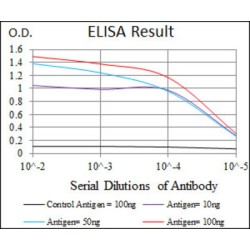 Sex-Determining Region Y Protein (SRY) Antibody