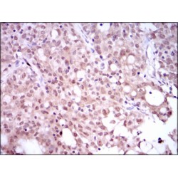 Sex-Determining Region Y Protein (SRY) Antibody