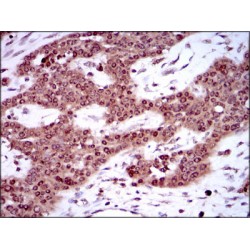 Sex-Determining Region Y Protein (SRY) Antibody