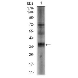 Sex-Determining Region Y Protein (SRY) Antibody