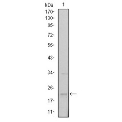 Snail Family Transcriptional Repressor 1 / SNAIL (SNAI1) Antibody