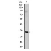 Western blot analysis using SNAI1 antibody against human SNAI1 (AA: 2-264) recombinant protein. (Expected MW is 31.3 kDa).