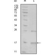 Western blot analysis using TNK1 antibody against truncated TNK1-His recombinant protein (1).