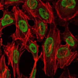 PC4 and SFRS1-Interacting Protein (PSIP1) Antibody