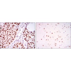 PC4 and SFRS1-Interacting Protein (PSIP1) Antibody