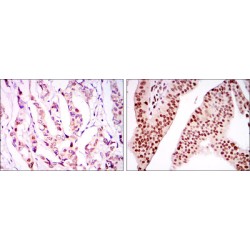 PC4 and SFRS1-Interacting Protein (PSIP1) Antibody