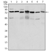 Western blot analysis using PSIP1 antibody against HepG2 (1), Jurkat (2), K562 (3), Cos7 (4), PC-12 (5), Hela (6), and NIH/3T3 (7) cell lysate.