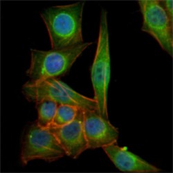 Tubulin Beta 3 (TUBB3) Antibody