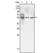 Western blot analysis using TUBB3 antibody against HepG2 (1), A549 (2) and Hela (3) cell lysate.