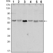 Western blot analysis using STK11 antibody against NIH/3T3 (1),Raw246.7 (2), COS7 (3), Jurkat (4), HEK293 (5) and A431 (6) cell lysate.