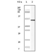 Western blot analysis using Vimentin antibody against truncated Vimentin recombinant protein.