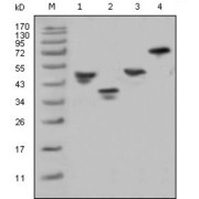 Western blot analysis using GST antibody against various fusion protein with GST tag.