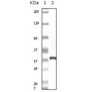 Western blot analysis using calcyclin antibody against truncated calcyclin recombinant protein.
