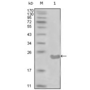 Western blot analysis using CD10 antibody against truncated CD10-His recombinant protein (1).