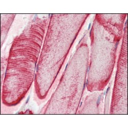 Crystallin Alpha B (CRYAB) Antibody