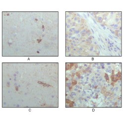 Crystallin Alpha B (CRYAB) Antibody