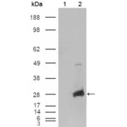 Western blot analysis using CRYAB antibody against HEK293T cells transfected with the pCMV6-ENTRY control (1) and pCMV6-ENTRY CRYAB cDNA (2).