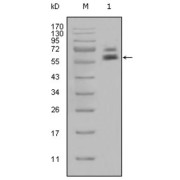 Western blot analysis using CK5 antibody against Hela cell lysate (1).