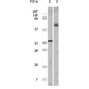 Western blot analysis using ELK1 antibody against truncated ELK1 recombinant protein (1) and K562 cell lysate (2).