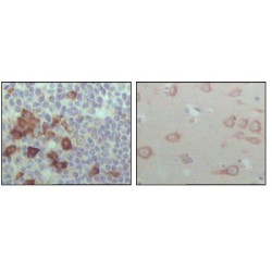 Ephrin Type-B Receptor 6 (EhpB6) Antibody