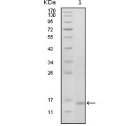 Western blot analysis using EhpB6 antibody against truncated EhpB6 recombinant protein (1).