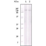 Western blot analysis of Jurkat (1) and NIH/3T3 (2) cell lysate using EphB6 antibody.