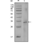 Western blot analysis using F8 antibody against truncated Trx-F8 recombinant protein (1).