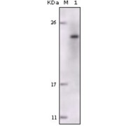 Western blot analysis using FES antibody against truncated FES recombinant protein.