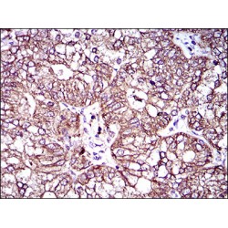 Multidrug Resistance-Associated Protein 4 (ABCC4) Antibody