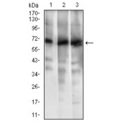 Western blot analysis using ABCG5 antibody against human ABCG5 recombinant protein. (Expected MW is 32.7 kDa).