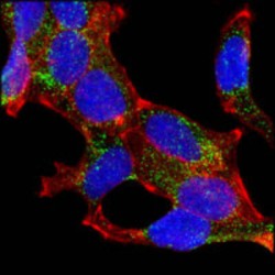 Alpha-Methylacyl-CoA Racemase (AMACR) Antibody