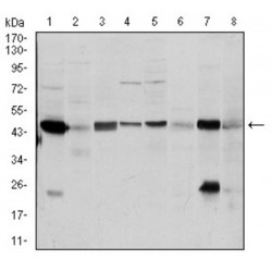 Argininosuccinate Synthase 1 (ASS1) Antibody