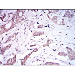 Bone Morphogenetic Protein Receptor 1A (BMPR1A) Antibody