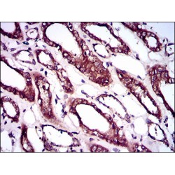 Bone Morphogenetic Protein Receptor 1A (BMPR1A) Antibody