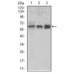 Bone Morphogenetic Protein Receptor 1A (BMPR1A) Antibody