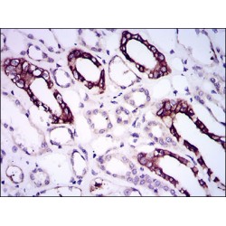 Bone Morphogenetic Protein Receptor 1A (BMPR1A) Antibody