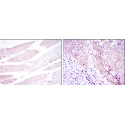 Bone Morphogenetic Protein Receptor 2 (BMPR2) Antibody