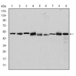 Chaperonin Containing TCP1, Subunit 2 (CCT2) Antibody