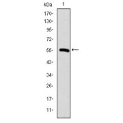 Western blot analysis using CCT2 antibody against human CCT2 (AA: 87-290) recombinant protein. (Expected MW is 47.9 kDa).