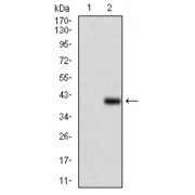 Western blot analysis using CD7 antibody against human CD7 recombinant protein. (Expected MW is 36.6 kDa).