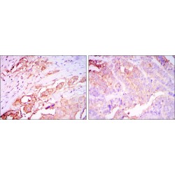 Carcinoembryonic Antigen (CEACAM5) Antibody