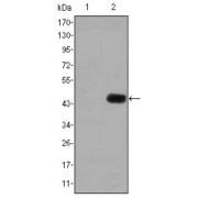 Western blot analysis using CEA antibody against HEK293 (1) and CEA (AA: 460-600) -hIgGFc transfected HEK293 (2) cell lysate.