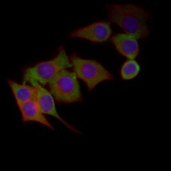 Chromogranin A (CHGA) Antibody