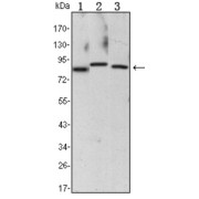 Western blot analysis using CHUK antibody against Raji (1), Jurkat (2) and THP-1 (3) cell lysate.