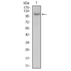 Calmegin (CLGN) Antibody