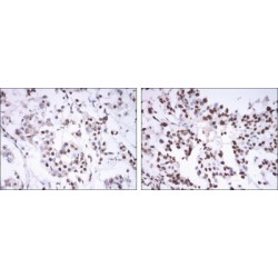 Estrogen Receptor (ESR1) Antibody