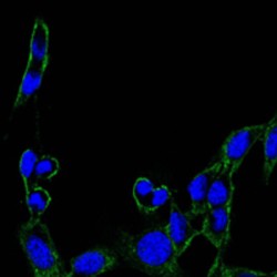 PTK2 Protein Tyrosine Kinase 2 (FAK) Antibody