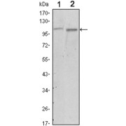 Western blot analysis using FAK antibody against A549 (1) and NIH/3T3 (2) cell lysate.