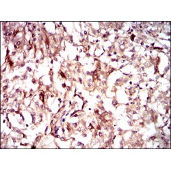 Guanylate Cyclase 1 Soluble Subunit Alpha 1 (GUCY1A1) Antibody